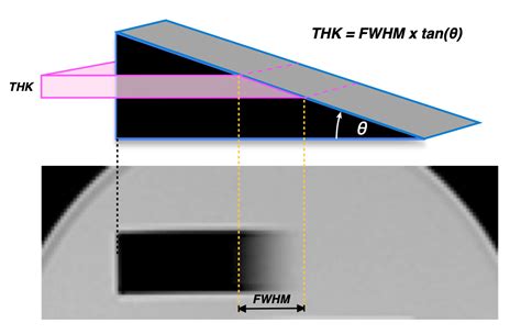 mri slice thickness test|mri parameters chart.